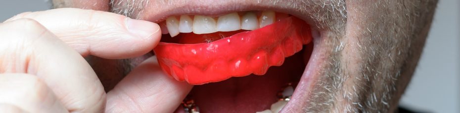 dose your mouthguard fit properly