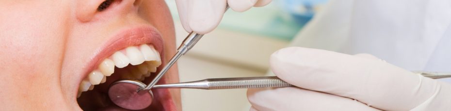 myths about dental sealants